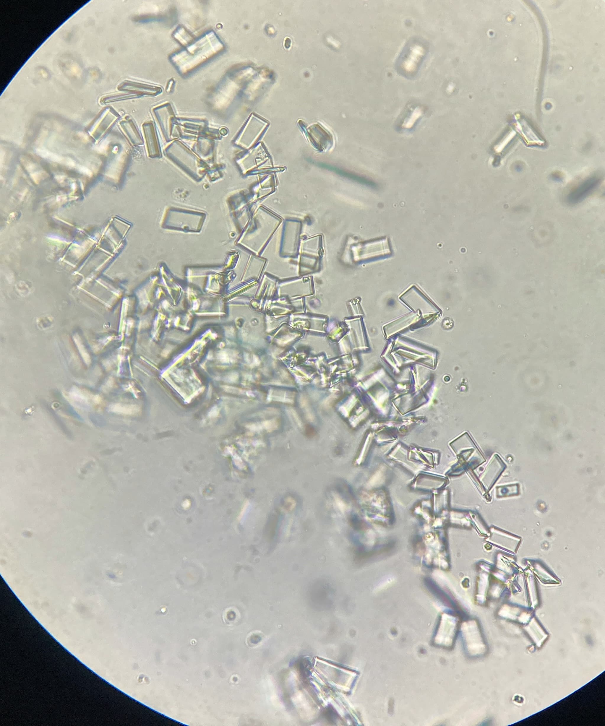 Protein crystals seen through a microscope at high magnification. Angular, transparent crystals of varying size scattered across the field.