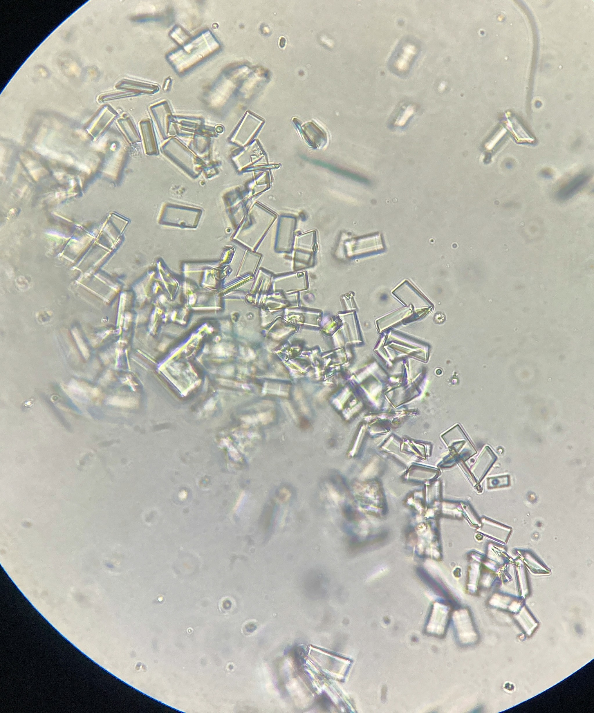 Protein crystals seen through a microscope at high magnification. Angular, transparent crystals of varying size scattered across the field.
